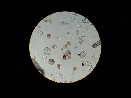 microplastics under the microscope 