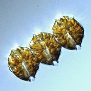 The dinoflagellate Alexandrium catenella. Photo credit: Gabriela Hannach, King County